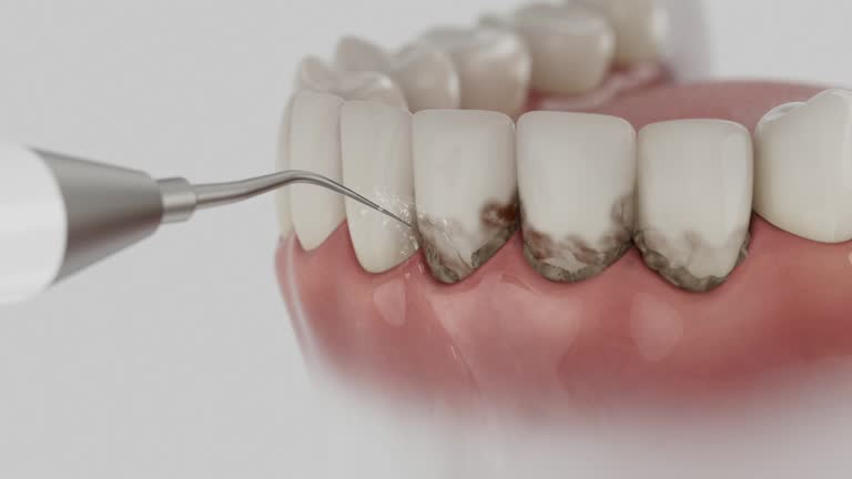 Trusted Teeth Cleaning And Checkup service in Brookville, PA - Dentist Open Now
